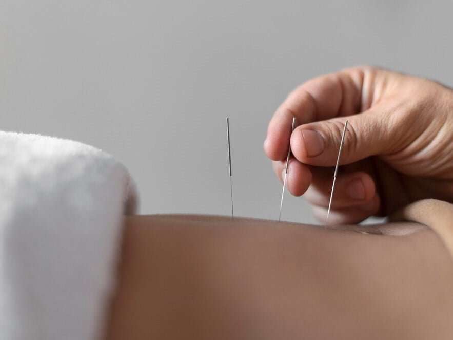 acupuncture soins energetiques